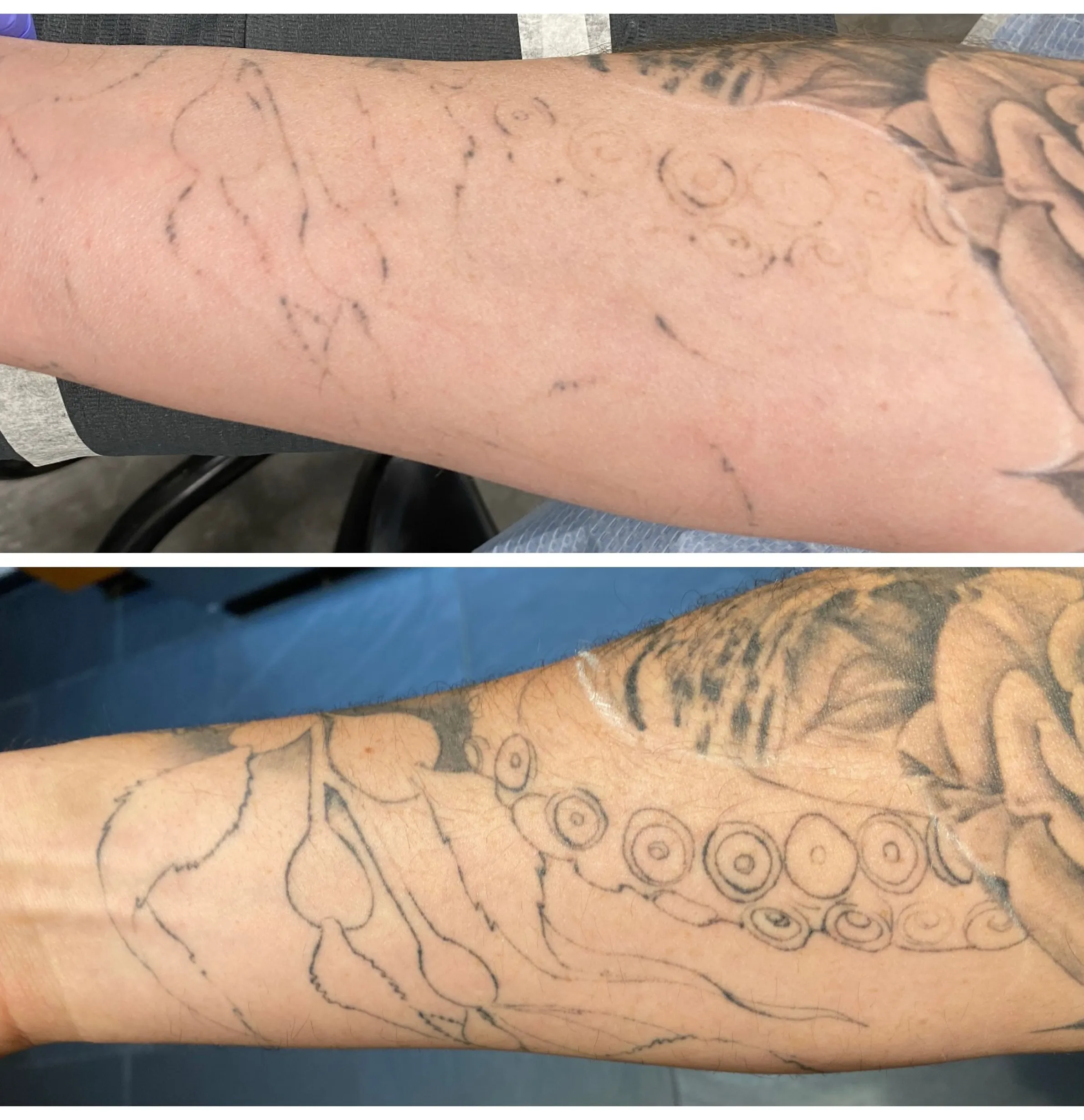 tattoo ink and liver detox